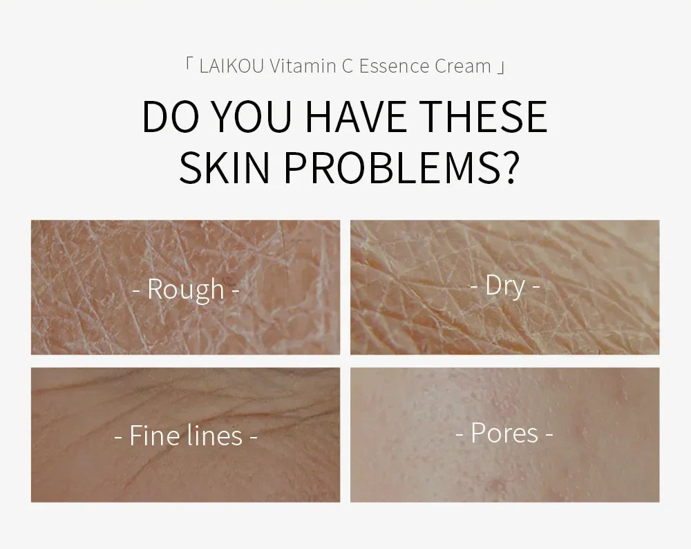 Vitamin C for Face Cream Reduces Dullness Pigments Dark Spots Firming Facial Cream  Lightening Skin Rejuvenation Beauty Health