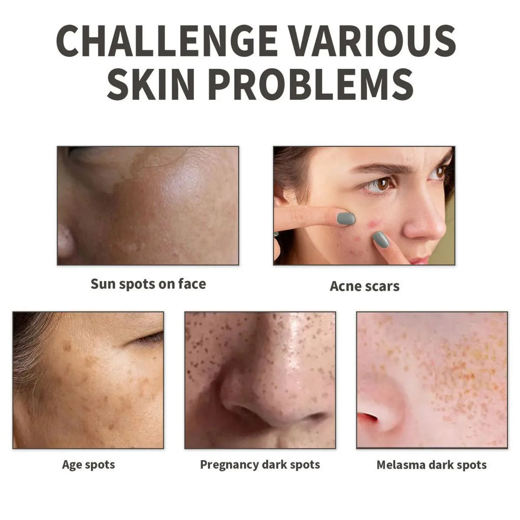 Vitamin B5 Face Serum Smooth Moisturizing Repair Dry Skin Aloe Soothe Pores Shrink Firming Hydrating Oil Control Facial Essence
